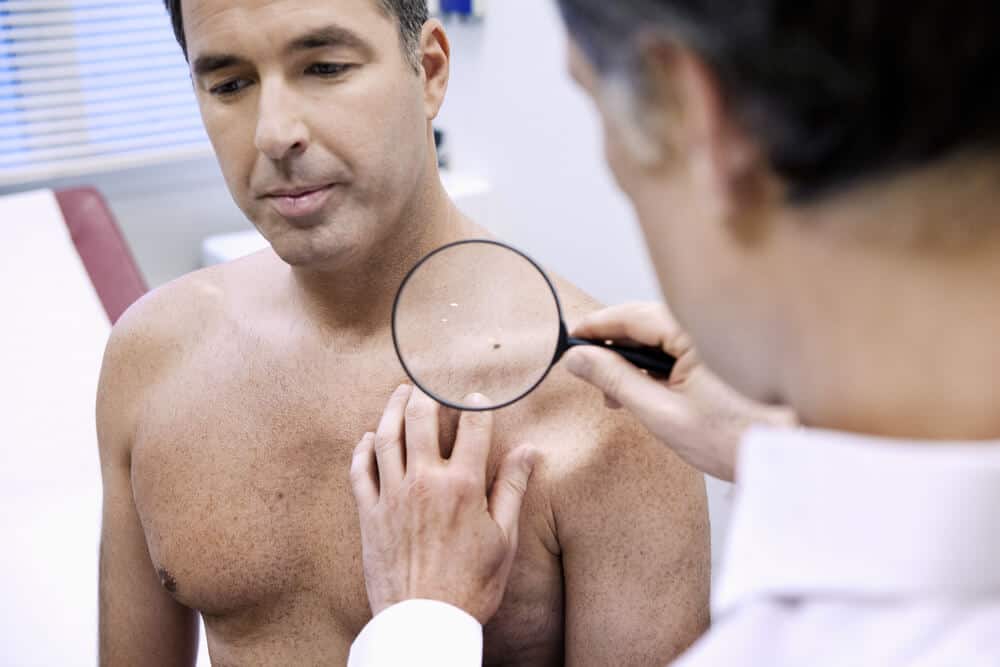 A doctor conducting a skin cancer screening on a patient.